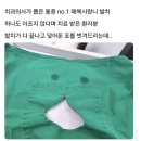 인성약국 | 사랑니 전문 치과에서 인생 첫 매복사랑니 발치 후기 | 3일차 통증 및 식사 기록