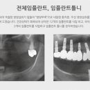 연세사랑니치과의원 이미지