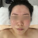 동탄 윤곽관리 잘하는 곳. 스킨스토리 솔직후기