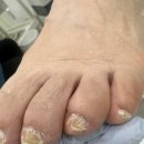 레푸스구미