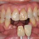 시그니처치과기공소 이미지