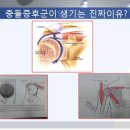 충돌증후군, 극상근건염, 회전근개파열이 생기는 진짜이유 이미지