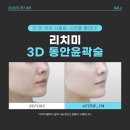 리치미의원 네이버블로그