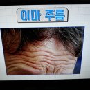 이마 주름,눈가 주름,콧등 주름/주름 다리미 마사지 공개/기치유센터 이미지