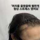 메디퓨처 | 동탄 헤어라인 [ 탈모쌤 퓨처그라데이션 동탄본점 ] 내돈내산 엄마 대변신 후기