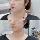 탐나다에스테틱 | 오늘은 뷰티! 서면에스테틱 더탐나에스테틱 | 부산윤곽관리 후기
