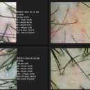 이선 헤어라인