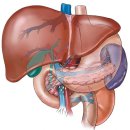 간경화증 (肝硬化症, liver cirrhosis) 이미지