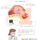 수축 | 31주 배뭉침 조기진통 증상 대처법 자궁수축방지제 후기