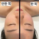 강서구 얼굴경락 효과 예비 신부관리 후기