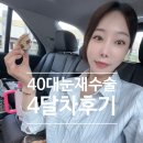 아티서클 | 40대 눈재수술 4달차 부작용 및 붓기 솔직 후기