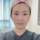 세븐일레븐 대구황금힐스테이트점 | 수성구 문제성 피부관리로 유명한 아비에르에서 피부나이 진단받고 왔어요