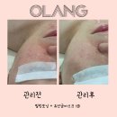 베네핏에스테틱 이미지