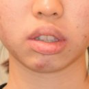 바른치과 이미지