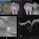 에이(A)플란트치과의원 | 부천역치과, '충치치료' 판단 기준에 대해 정리해드리겠습니다.