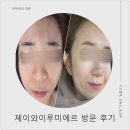 제이와이솔루션 | 수원 피부관리 리뷰, 광교 에스테틱 제이와이루미에르 다녀 온 후기(비포&amp;애프터 사진 있음)