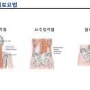 N약침 이미지