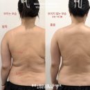 무니크뷰티(Moonique) | 비포 에프터 사진을 진짜 여러번 보게 되는 웨딩관리 전신관리