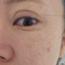 아이블룸 | 눈밑 쥬베룩 내돈내산, 블룸쥬베룩 아이 후기