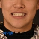 아이콘치과교정과의원 네이버블로그