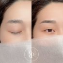 비프리티 이미지