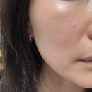 톤 온 톤 | 일산압구정언니에서 얼굴톤 정리하고 온 솔직 후기(화이트닝)