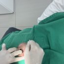 강남역치과 충치치료 꼼꼼한 진단으로 인레이·레진 치료받은 내돈내산 후기｜강남치과 추천