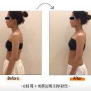 위뷰티 네이버블로그