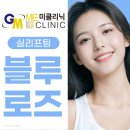 로즈멍 | 실리프팅유지기간 효과 가격 블루로즈 잘하는곳 후기