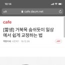 새빛안과의원 이미지