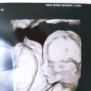 뉴본 여성병원