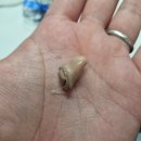 화명독일보청기 이미지