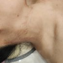 사바비안양주 | 양주 옥정 아토피 문제성 피부관리 마사지 사바비안 추천