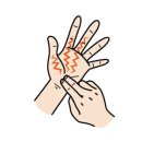 수근관증후군, 손을 많이 쓰면 더 저리다. 이미지