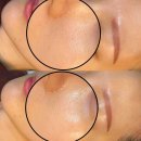 오닉스스킨테라피 | 왕십리피부관리 잘하는 곳, 오닉스 스킨테라피 방문후기