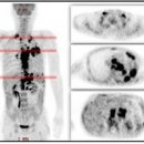 PET CT 검사 방법 준비 비용 (펫시티) 이미지