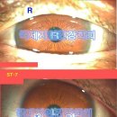 홍채교육임상/스터디19홍채임상학(아름다운눈 건강을말해요)최만규저-생활이침/국제자연건강학회 이미지