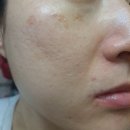 컬처바이오 | 바이오힐 보 프로바이오덤 3D 리프팅 크림으로탄력있는 피부로 만들어요.