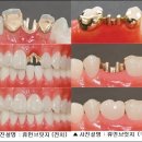 휴먼브릿지