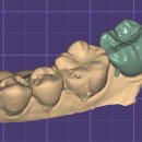 지안치과기공소 이미지