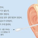 귀염증약 귀에 이어폰 귀 염증 피어싱 뚫은곳 아플 때! 이미지