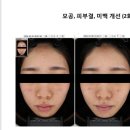 피지아이주