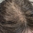 (주)이노진 | 꿉꿉한 두피 시원하게 해주는 볼빅 솔트케어 스타일러🧴