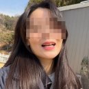 밝은내일치과의원 | 결혼 전 치아미백 내돈내산 후기