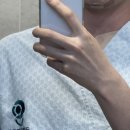 갑상선암 바로 알기 | 세상에 이런 일이 2편 - 갑상선암