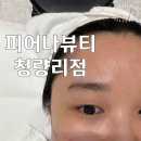 피어나테라피 - 양평군 | 여드름피부관리 피부스케일링 잘하는 곳 피어나뷰티 청량리점