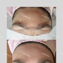 롬프란 스킨앤바디 이미지