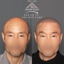 더빛Arkkids작은도서관 | 여의도 탈모 디자인 후기｜60대 교수님의 현실적인 삭발 선택