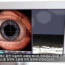 세란안과의원 네이버블로그