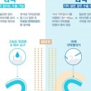 눈사랑성모안과의원 네이버블로그